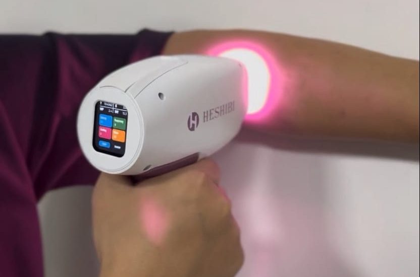 How to Achieve Silky Smooth Skin with ODM Diode Laser Hair Removal Without the Hassles of Traditional Methods?